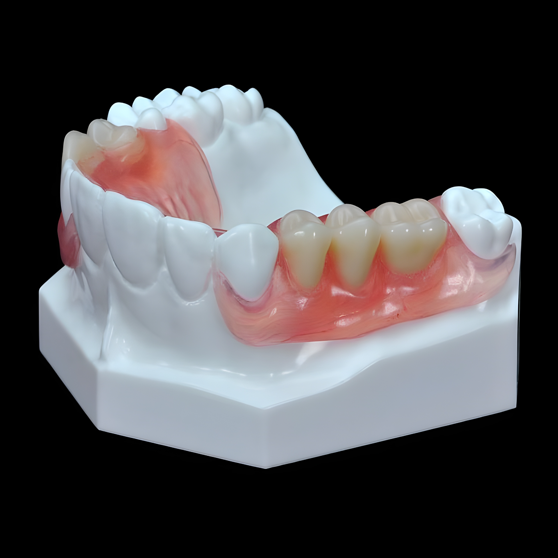 Valplast